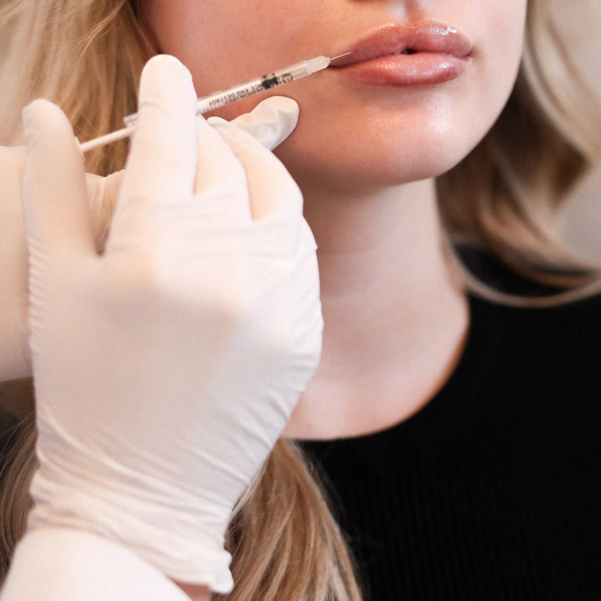 Gloved hand injecting lips
